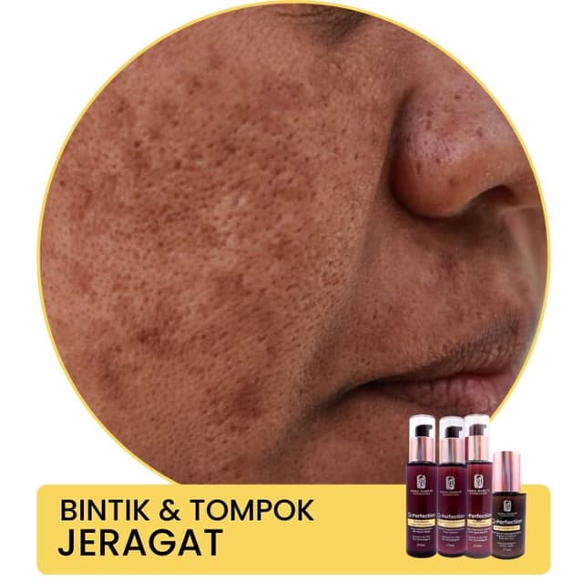 Image showing skin irritation from harmful cosmetics