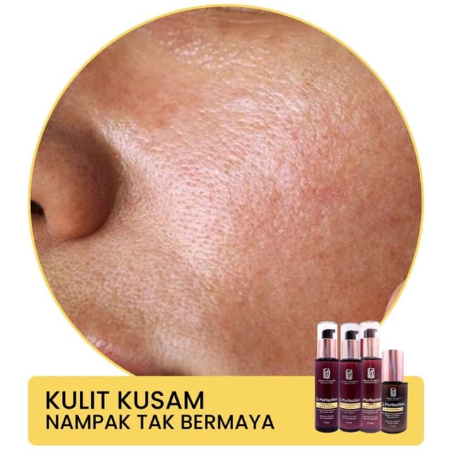 Image depicting chemical burns on skin
