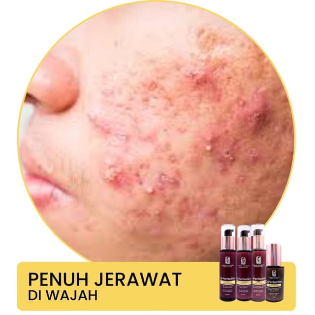 Image of a severe allergic reaction on the face