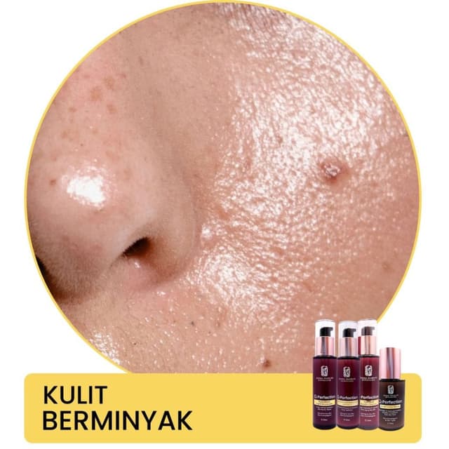 Image of acne breakout caused by bad ingredients