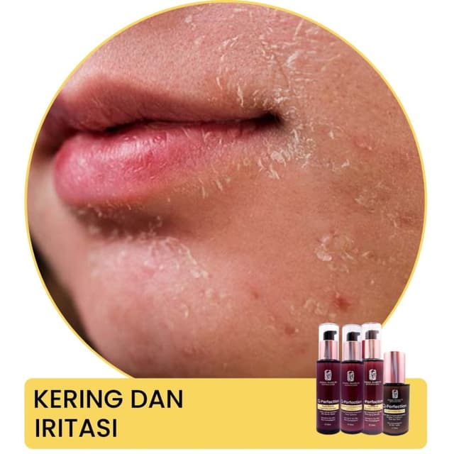 Image of skin damage and premature aging